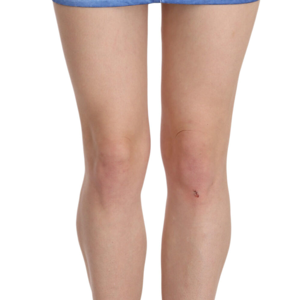 Blue Cotton Stretch Casual Mini Skirt